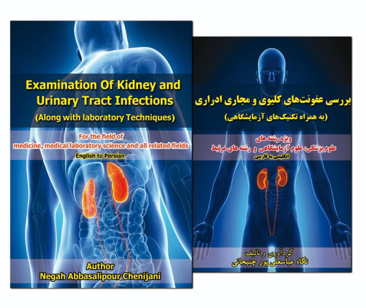 Examination of kidney and urinary tract infections along with laboratory techniques / بررسی عفونت‌های کلیوی و مجاری ادراری به همراه تکنیک‌های آزمایشگاهی