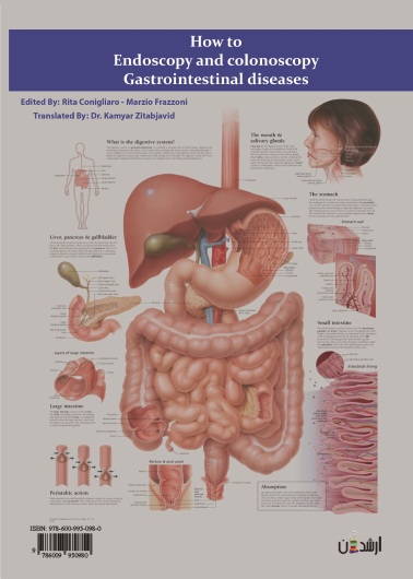 نحوه آندوسکوپی و کولونوسکوپی بیماری های دستگاه گوارش